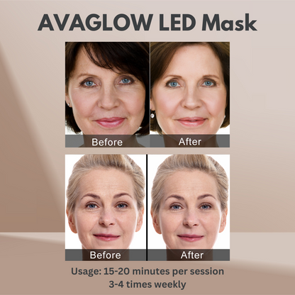 Avaglow Renew LED Mask